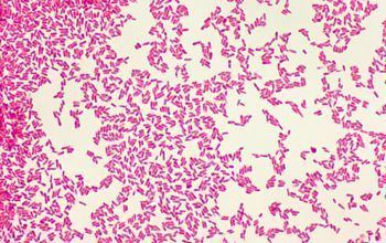 Cardiobacterium hominis Cardiobacterium hominis