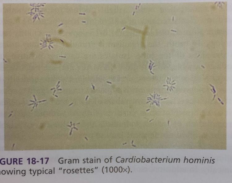 Cardiobacterium hominis Haempphilus and other fastidious GNB Biological Sciences 4090 with