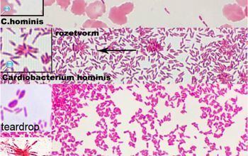 Cardiobacterium hominis Cardiobacterium hominis