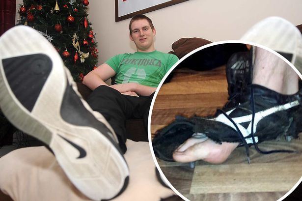 Carl Griffiths Rugby player with SIZE 21 feet has had to hang up his