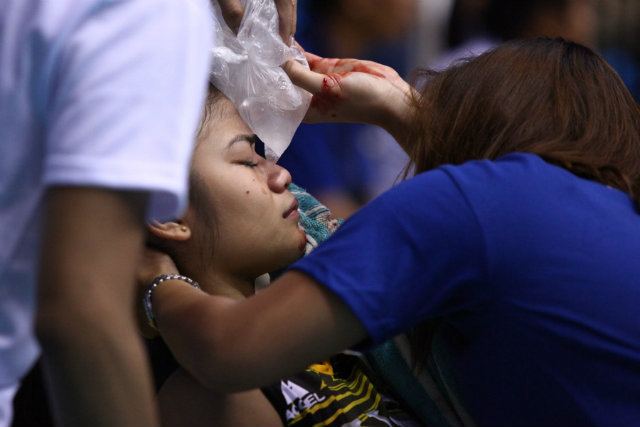 Carmela Tunay USTs Tunay suffers fractured nose