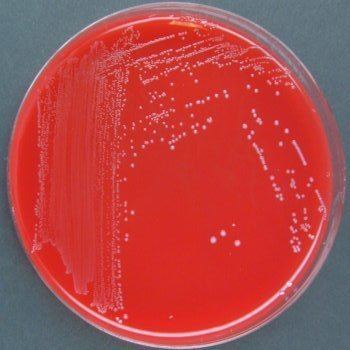 Carnobacterium carnobacteriumjpg