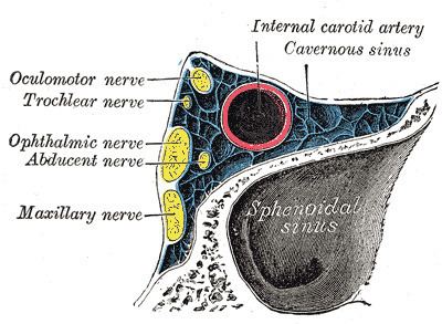 Carotid-cavernous fistula