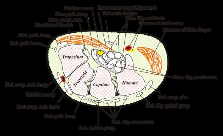 Carpal tunnel syndrome