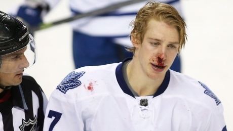 Carter Ashton Leafs39 Carter Ashton suspended by NHL NHL on CBC Sports