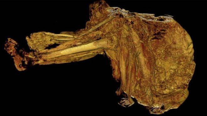 Cashel Man World39s oldest bog body hints at violent past BBC News