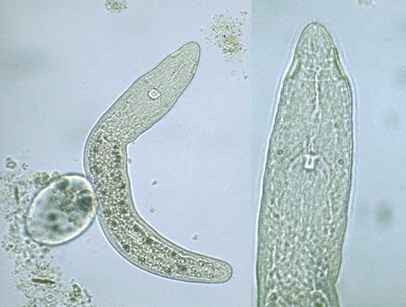 Catenulida Platyhelminthes with endosymbiotic Chlorella