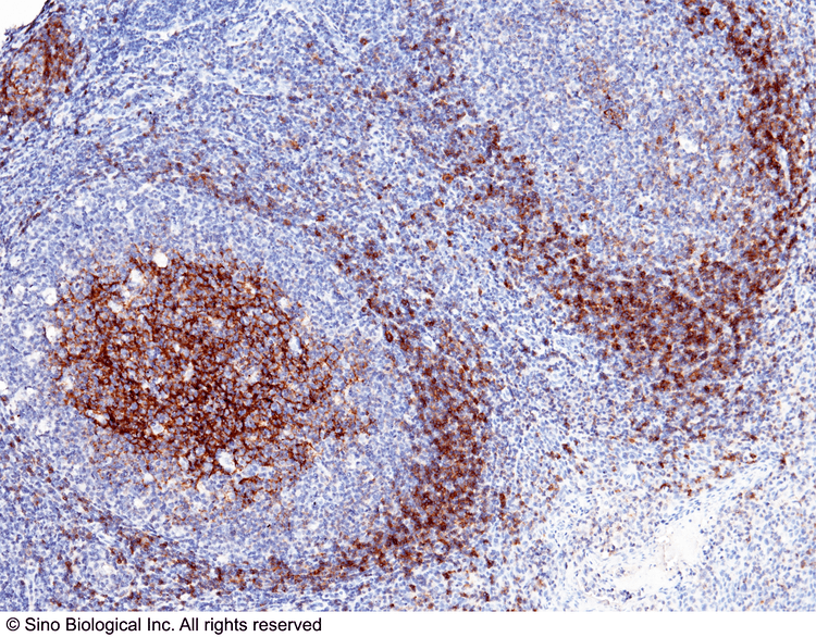 CD23 wwwsinobiologicalcdncomproductsimgImmunochemi