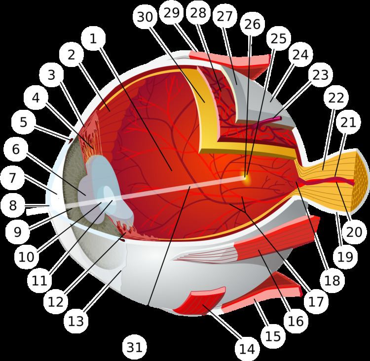 Central retinal vein occlusion