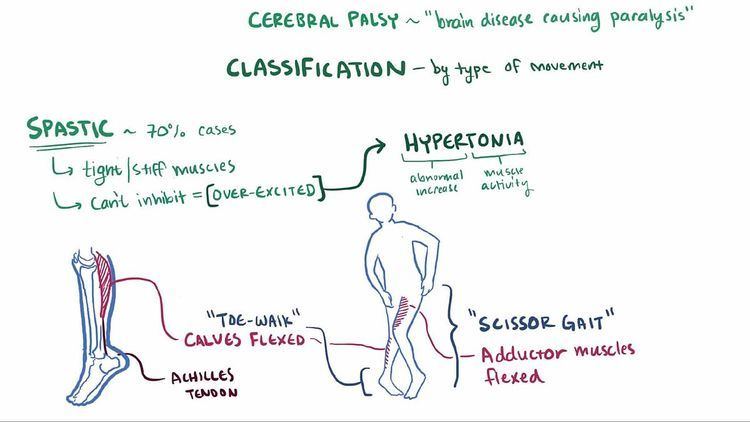 Cerebral palsy sport classification