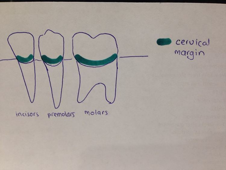 Cervical margins