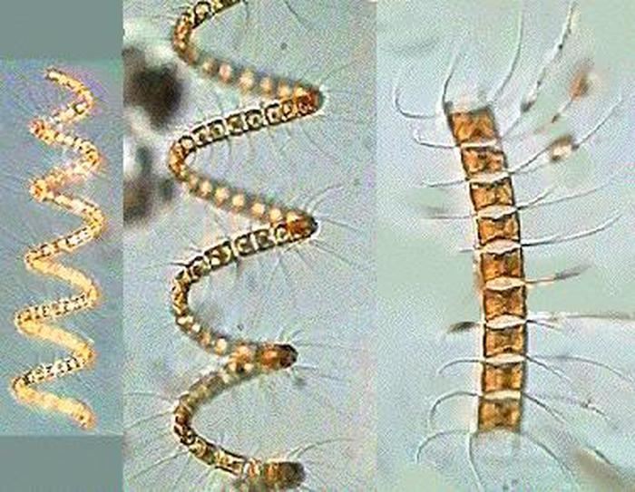 Chaetoceros Chaetoceros curvisetus PT Cleve 1889 Nordic Microalgae