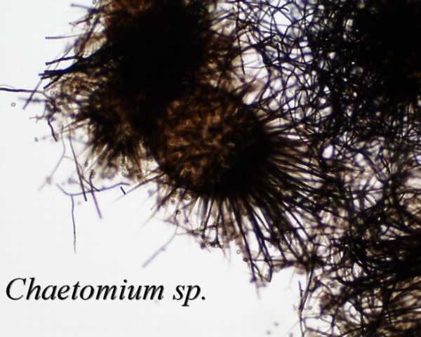 Chaetomium Chaetomium sp