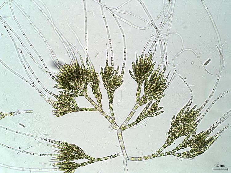 Chaetophora (alga) dbmusebladecoloradoeduDiatomTwosbsacsiteimag