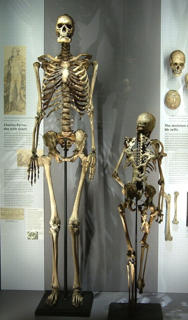 Charles Byrne (giant) skeletoncharlesbyrnedisplayjpg