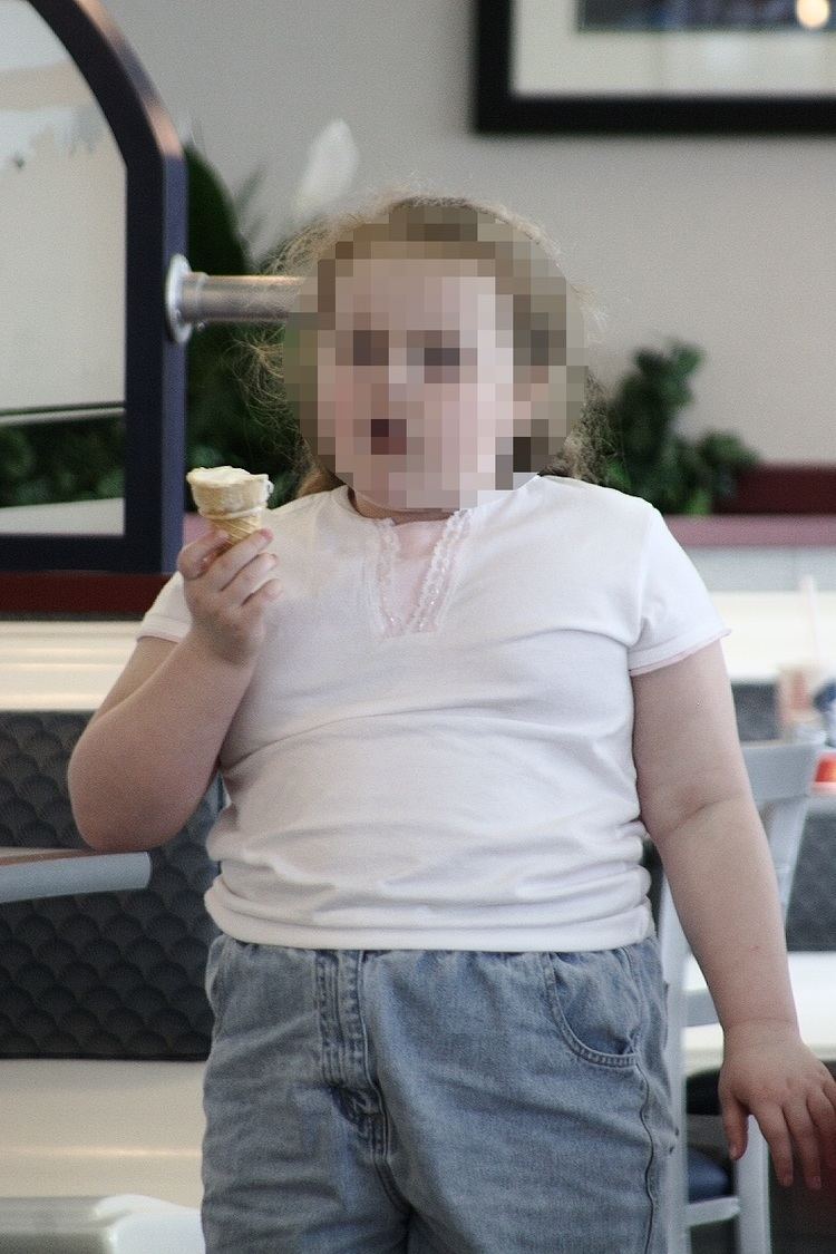 Childhood obesity in Australia