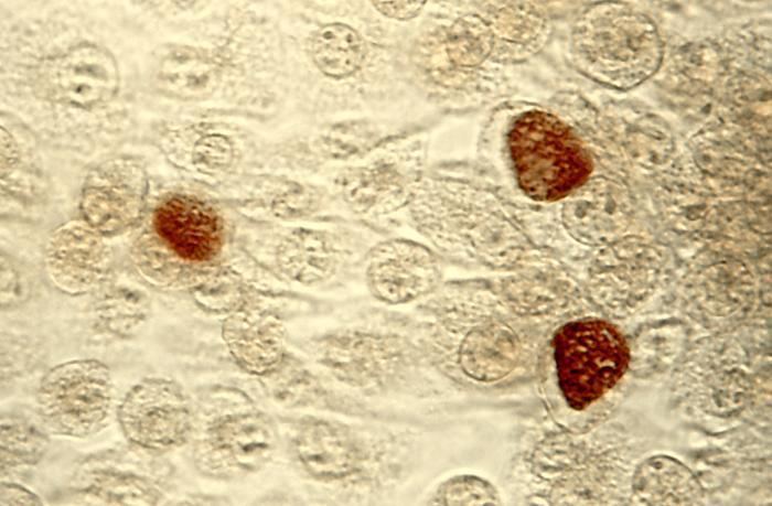 Chlamydia (genus)