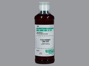Chlorhexidine chlorhexidine gluconate mouth and throat Uses Side Effects