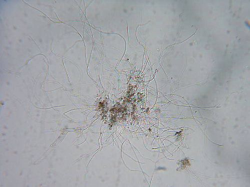Chloroflexus aurantiacus Bacteria Chloroflexus aurantiacus Found in pond water D Flickr
