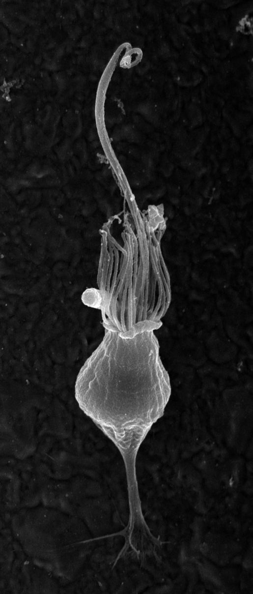 Choanoflagellate Choanoflagellates and animal multicellularity dayelcom