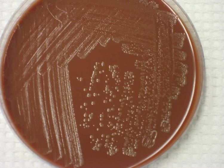 Chocolate agar GRAMNEGATIVE RODS of Haemophilus influenzae Medical Laboratories