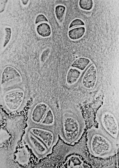 Chondrocyte