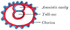 Chorionic hematoma - Alchetron, The Free Social Encyclopedia