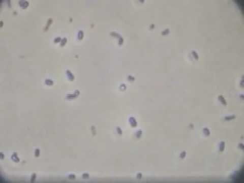 Chromatium Chromatium sp a motile purple sulphur bacterium YouTube