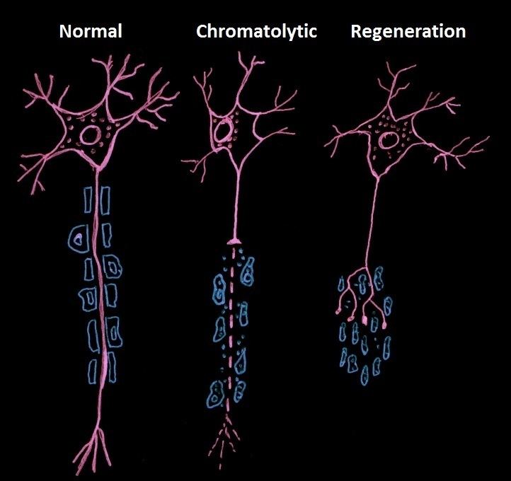 Chromatolysis