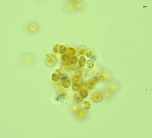 Chromera velia From algae to parasites new 39missing link39 species found in Sydney