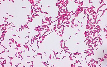 A light purple Chromobacterium violaceum under a microscope.