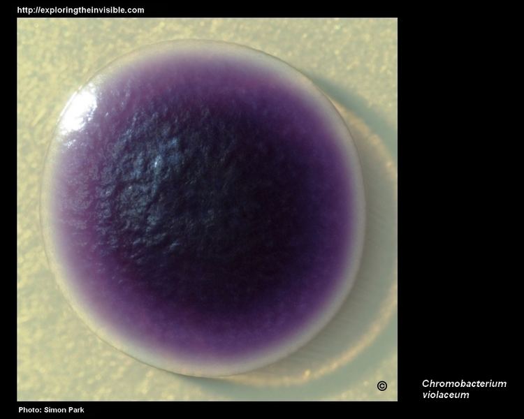 A purple Chromobacterium violaceum under a microscope.