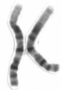 Chromosome 1 (human)