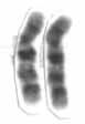 Chromosome 10 (human)