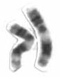 Chromosome 11 (human)