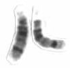 Chromosome 14 (human)