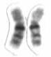 Chromosome 16 (human)