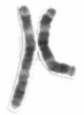 Chromosome 3 (human)