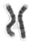 Chromosome 4 (human)