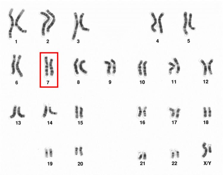 Chromosome 7 (human)
