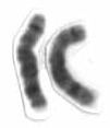 Chromosome 8 (human)