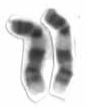 Chromosome 9 (human)