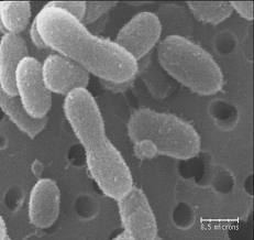 Chryseobacterium httpsmicrobewikikenyoneduimages111Cgreenl