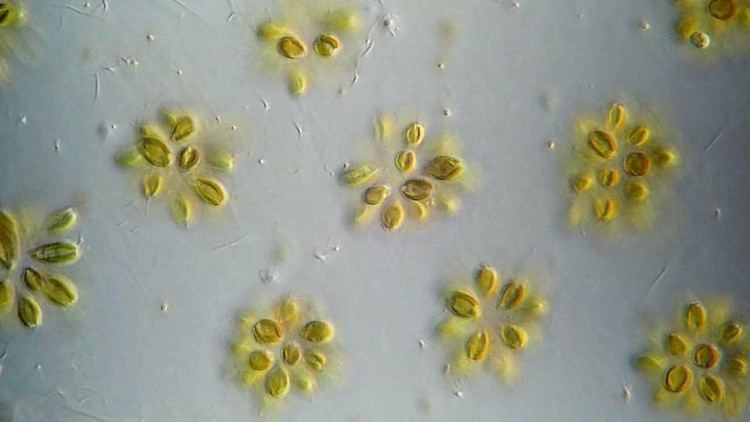Chrysophyta Synura golden colonial algae Chrysophyta 400x YouTube