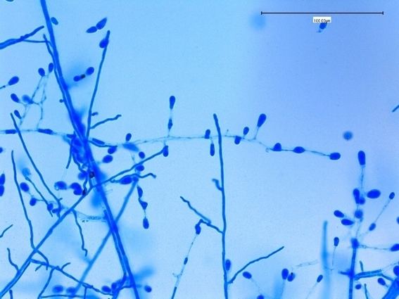 Chrysosporium Fun With Microbiology What39s Buggin39 You Chrysosporium species