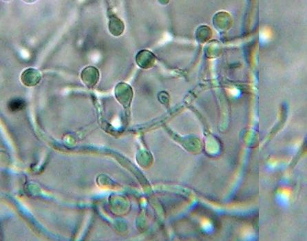 Chrysosporium websitenbmmnbcamycologywebpagesMouldsIllustr