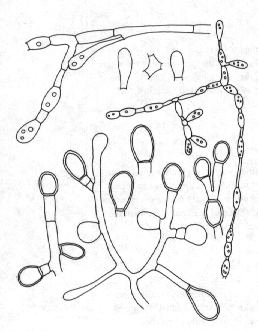 Chrysosporium Chrysosporium