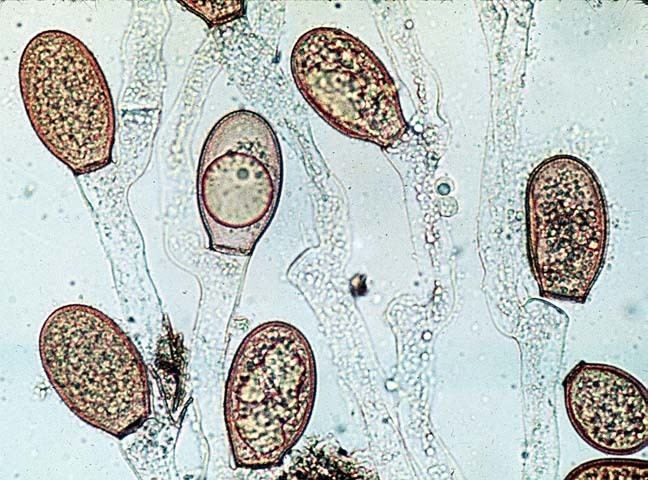 Phylum Chytridiomycota
