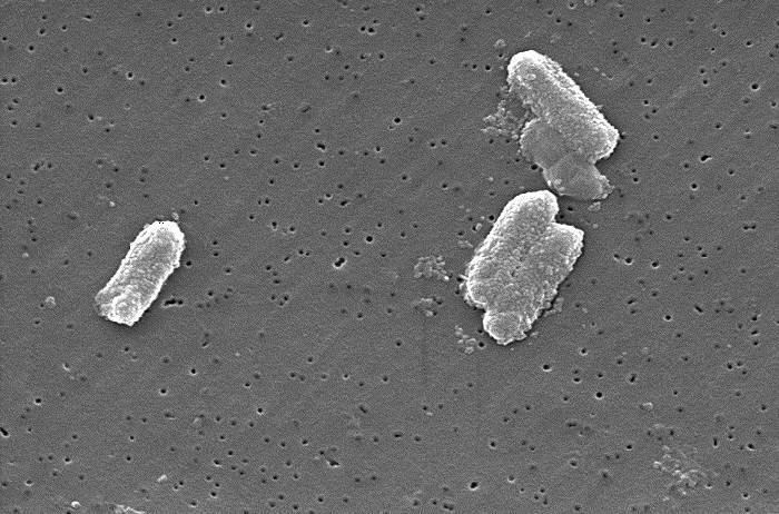 Citrobacter httpsuploadwikimediaorgwikipediacommons55