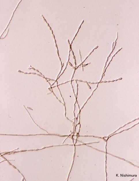 Cladophialophora bantiana Cladophialophora bantiana microscopy